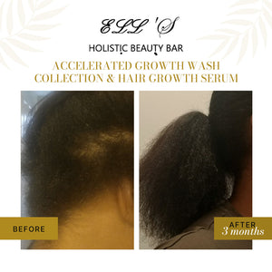 Accelerated Growth Wash Bundle