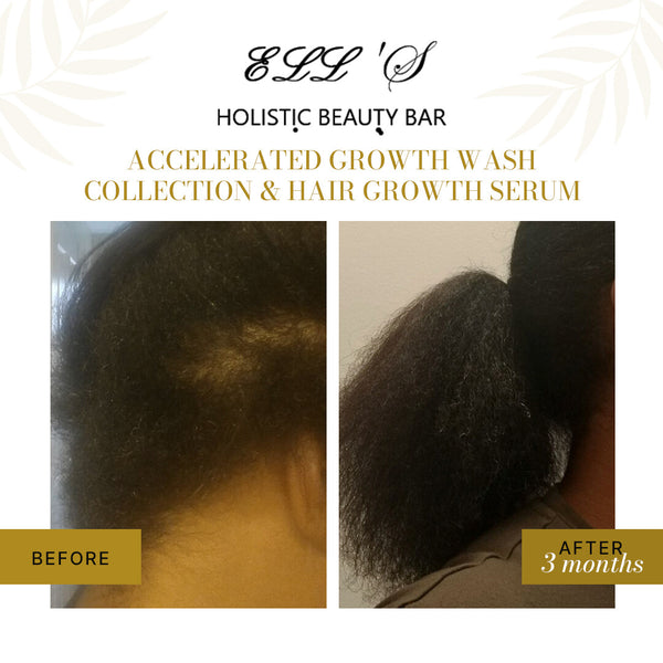 Accelerated Growth Wash Bundle
